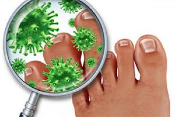 Дерматизон гель: эффективное средство против грибковых инфекций кожи и ногтей